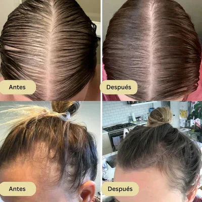 Vitaorganic - Aceite Para El Crecimiento del Cabello 🌿