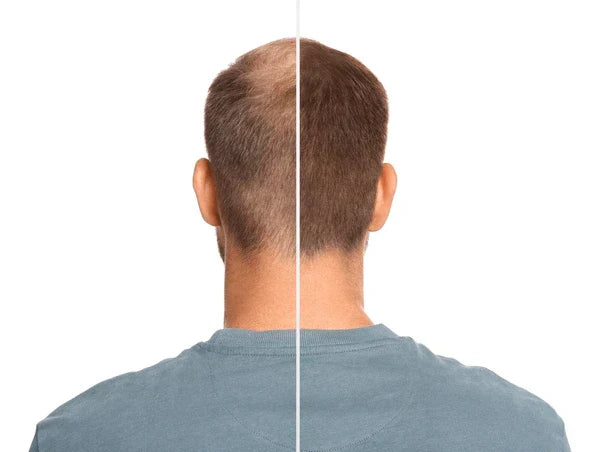 Vitaorganic - Aceite Para El Crecimiento del Cabello 🌿