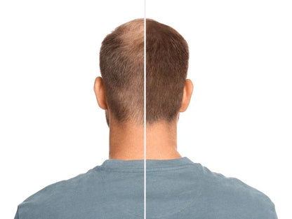 Vitaorganic - Aceite Para El Crecimiento del Cabello 🌿